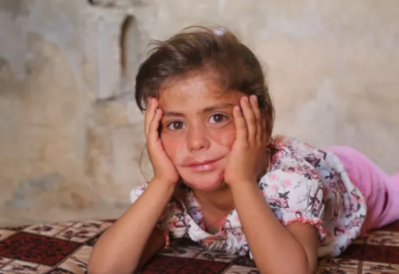 Sama smiling with her face between her hands. 